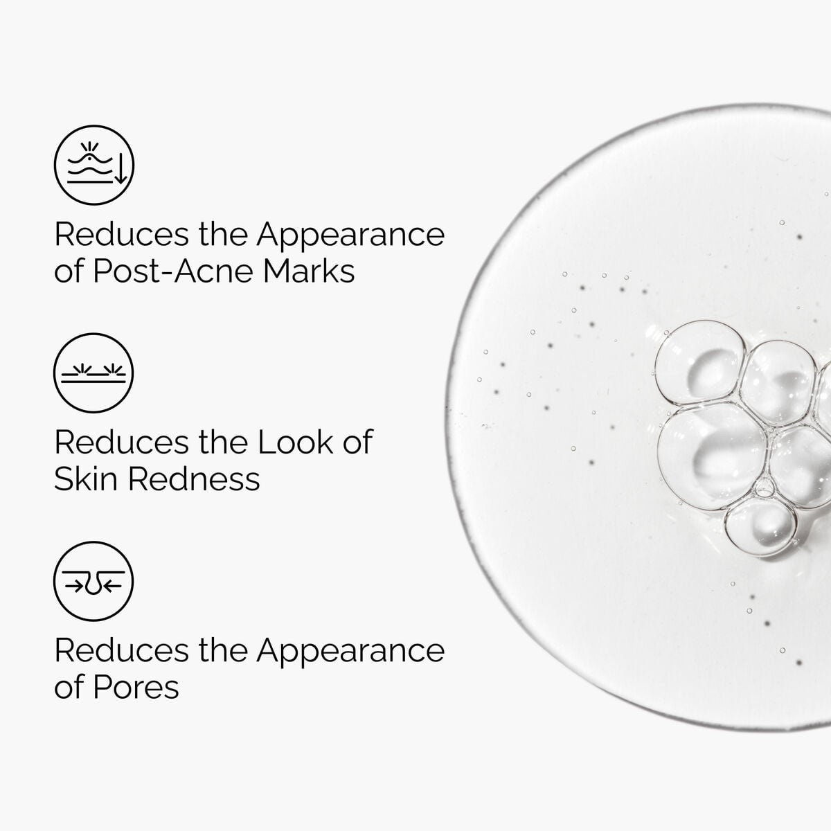 Aloe 2% + NAG 2% Solution - Skin Support