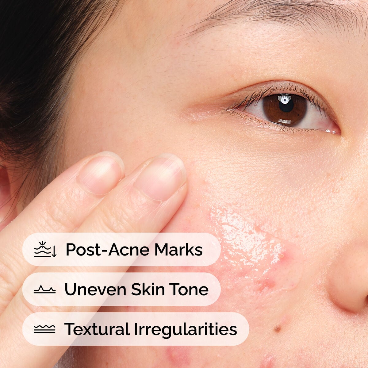 Aloe 2% + NAG 2% Solution - Skin Support