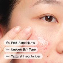 Aloe 2% + NAG 2% Solution - Skin Support