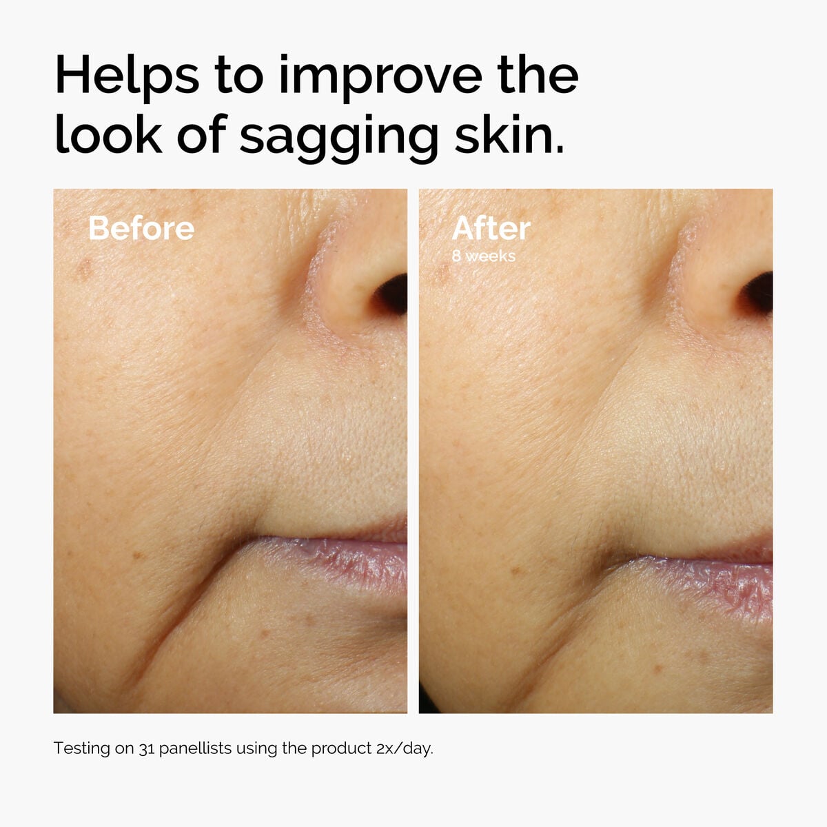 3% + Escin 1% Face Serum - Fresh Reset