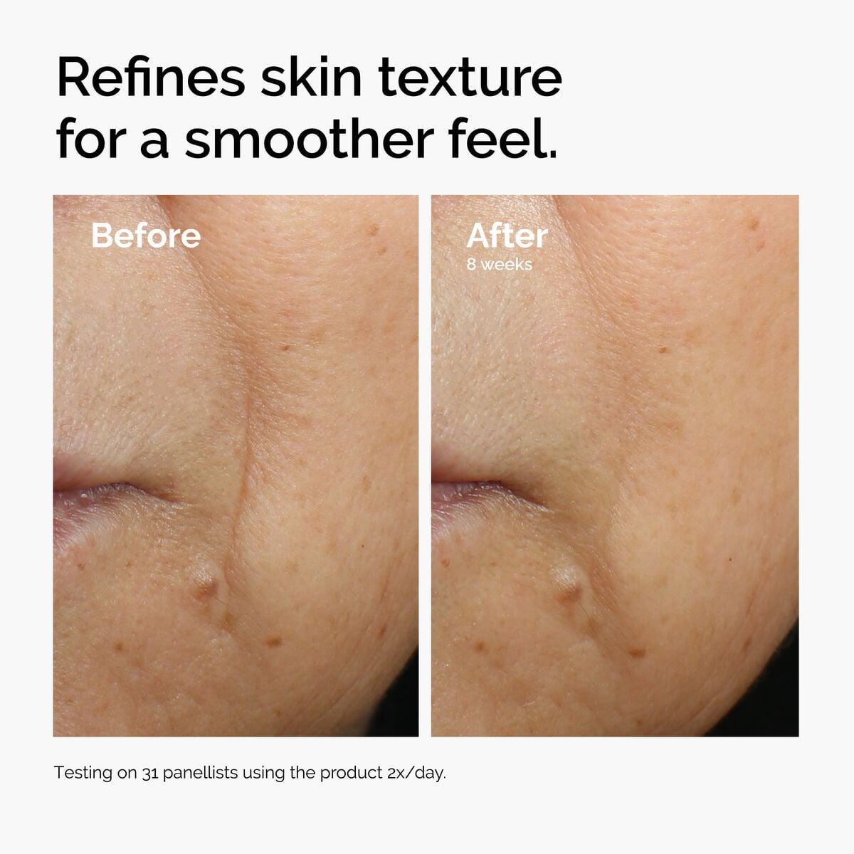 3% + Escin 1% Face Serum - Easy Routine