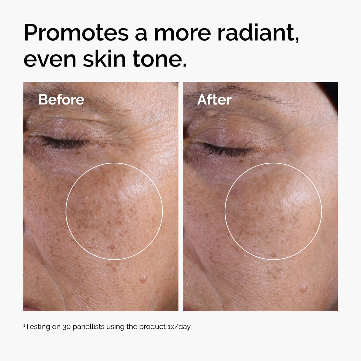 Acid 7% Exfoliating Toner - Easy Set