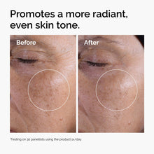 Acid 7% Exfoliating Toner - Easy Set