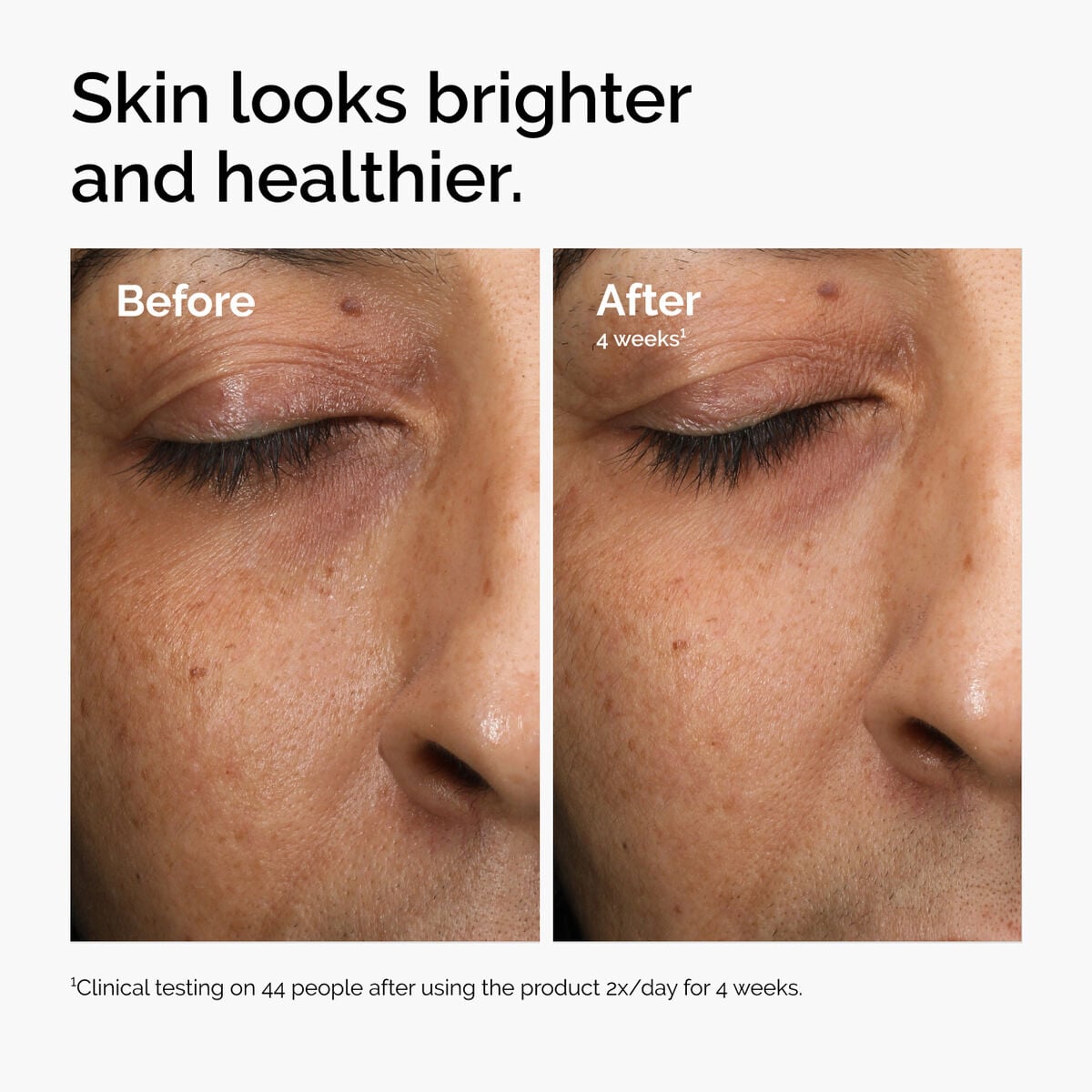 Multi-Antioxidant Radiance Serum - Calm Care