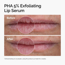 PHA 5% Exfoliating Lip Serum - Modern Glow