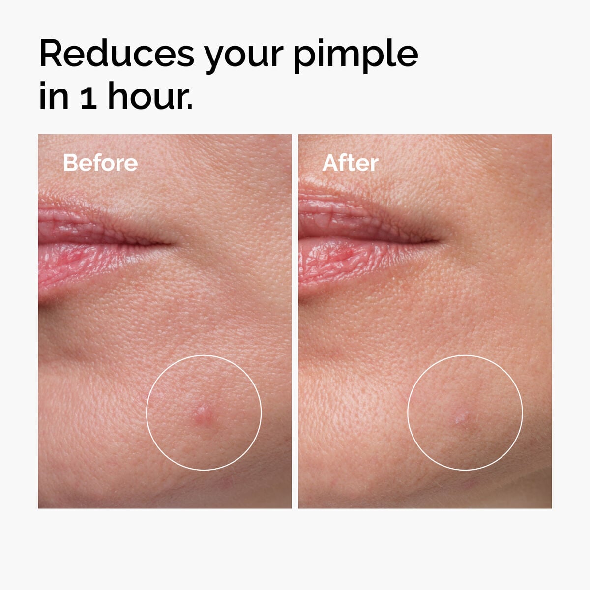 Sulfur 10% Powder-to-Cream Concentrate - Gentle Reset